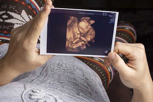 pregnant lady looking at her ultrasound photo